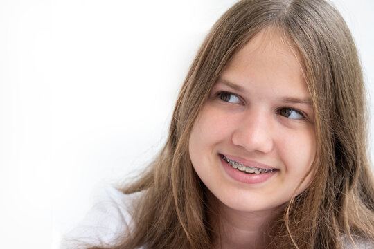 Cheerful smiling teenage girl with dental braces and long hair looking at copy space, white background