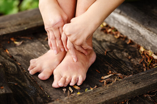 Female hands and feet affected by polyarthritis with joint deformity and swollen ankles. Medical concept of rheumatoid arthritis, chronic pain, systemic disease and rheumatology.