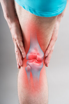 Knee pain, joint inflammation, arthritis and degenerative changes. Male leg with bone x-ray image, painful area highlighted in red