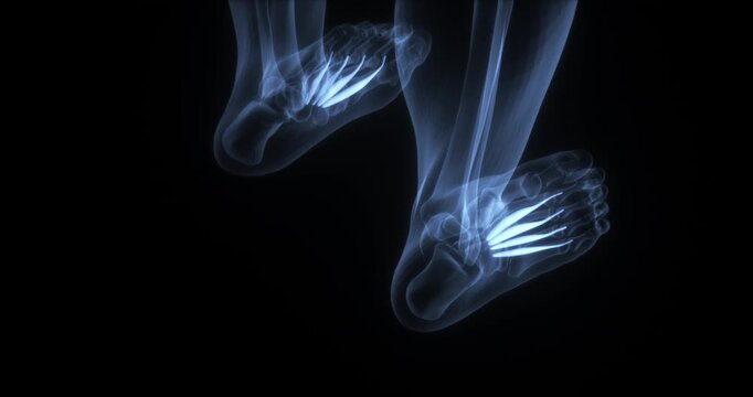 Lumbrical muscles of the foot in the human body. X Ray. Loop