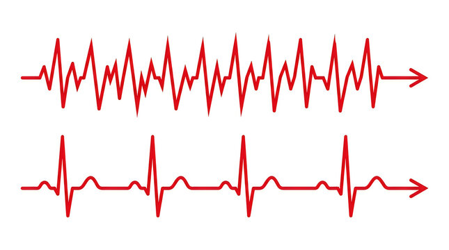 Two different heart rate electrocardiogram ecg lines isolated on white background