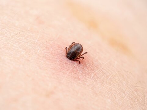 Close-up of a dangerous tick parasite embedded in human skin