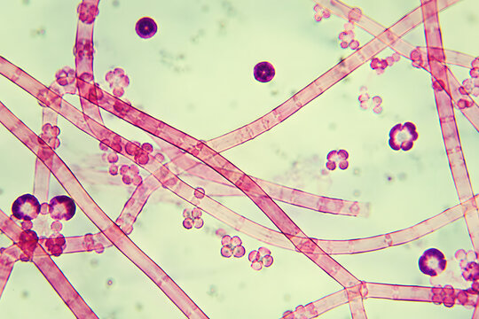 High-magnification microscope image of fungal hyphae and round yeast-like cells, illustrating mycology, microbiology, laboratory diagnostics, and fungal biology.