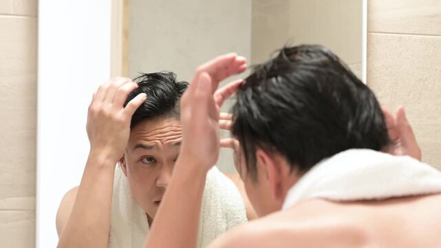 髪の生え際を気にする日本人男性