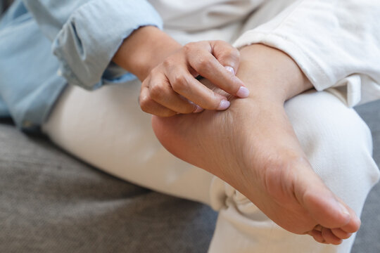 Close-up bare feet of person feeling itchy and irritated try to scratching by toe.