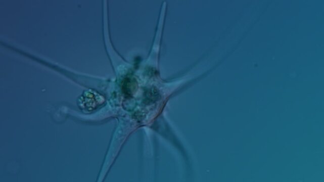 Amoeba radiosa at 50x under Nomarski DIC microscopy