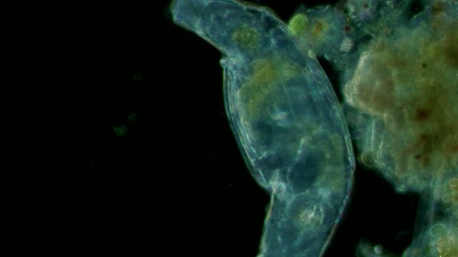 Bdelloid rotifer at 20x under darkfield microscopy