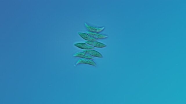 Scenedesmus acutus algae at 50x under Nomarski DIC microscopy