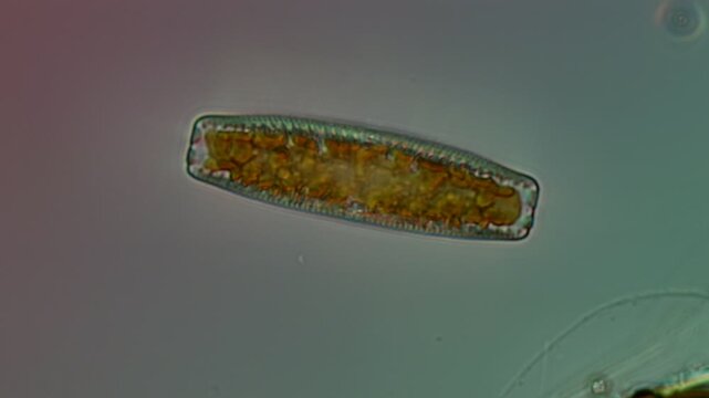 Epithemia sp. diatom at 50x under Nomarski DIC microscopy