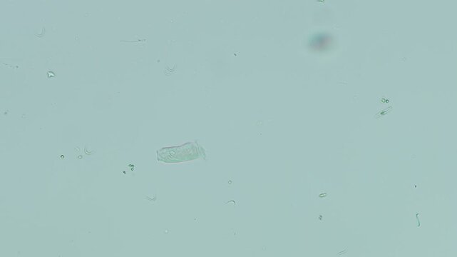 Vorticellid telotroch at 10x under brightfield microscopy