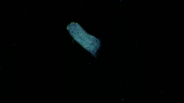 Vorticellid telotroch at 20x under darkfield microscopy