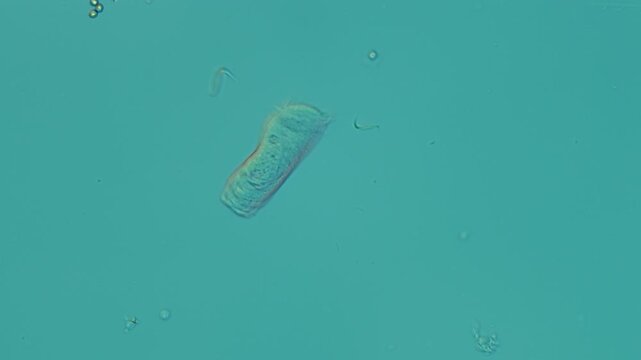 Vorticellid telotroch at 20x under Nomarski DIC microscopy