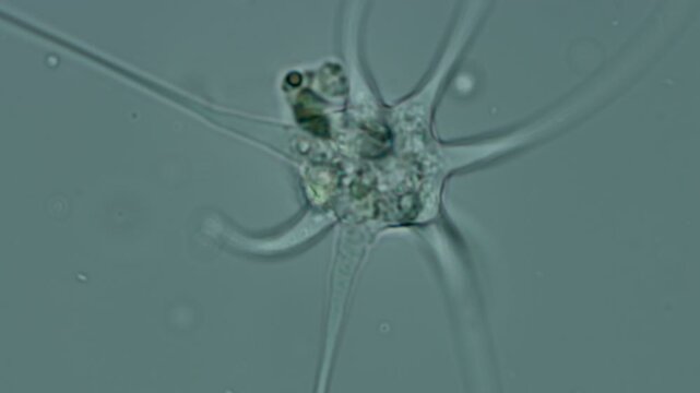 Amoeba radiosa at 50x under brightfield microscopy