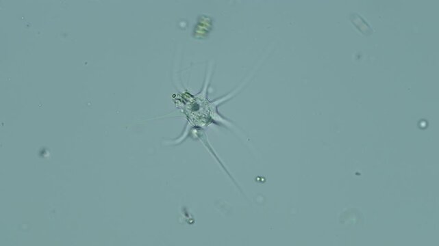 Amoeba radiosa at 20x under brightfield microscopy