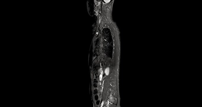 Wide medical animation of a whole spine and body MRI sagittal series scrolling through slices in monochrome with large black copy space on both sides.