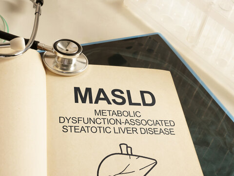 MASLD Metabolic Dysfunction Associated Steatotic Liver Disease Awareness with Fatty Liver Diagnosis Metabolic Syndrome Obesity Insulin Resistance Liver Health and Early Prevention