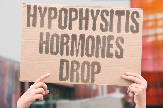"Hypophysitis Hormones Drop" Describe pituitary gland inflammation from immunotherapy. HYPOPHYSITIS. PITUITARY. HORMONE. DEFICIENCY. REPLACEMENT.