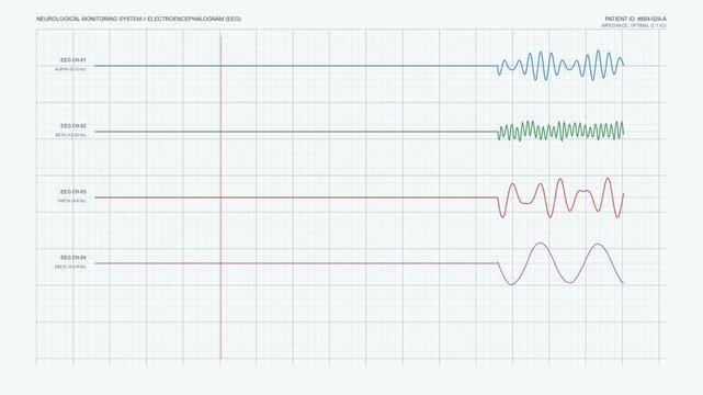 Medical EEG Brainwave Monitor Display, Multi Channel Electroencephalogram Signal Scan, Light Theme Neurology Telemetry 60fps