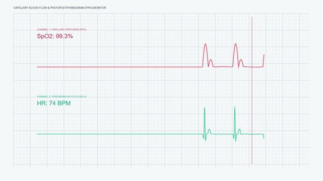 Capillary Blood Flow Photoplethysmogram PPG Monitor Display, Synchronous Medical ECG Pulse Waveform Telemetry, High Key Laboratory Screen Loop 60fps