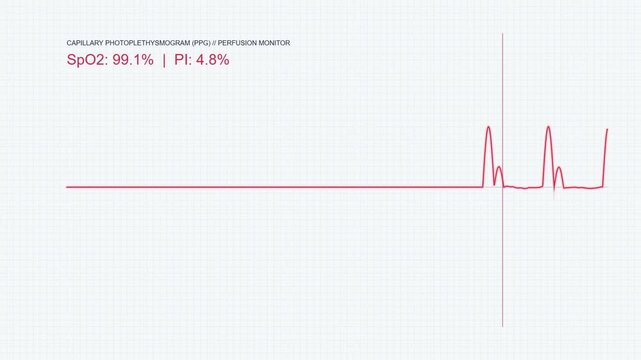 Capillary Photoplethysmogram PPG Waveform Macro, Medical Blood Oxygen Saturation SpO2 Pulse Telemetry Screen, Light Theme Laboratory Loop 60fps