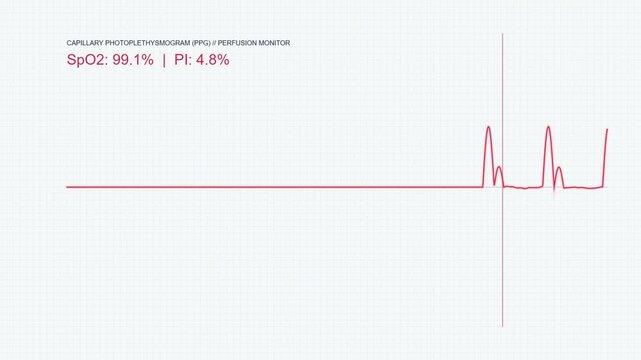 Capillary Photoplethysmogram PPG Waveform Macro, Medical Blood Oxygen Saturation SpO2 Pulse Telemetry Screen, Light Theme Laboratory Loop 60fps