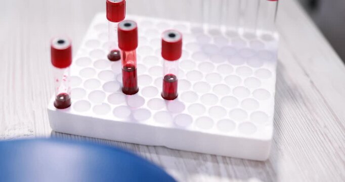 Laboratory worker putting test tube into rack and woman with needle in her hand during intravenous procedure, selective focus. Camera moving forward