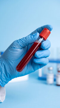 Laboratory scientist wearing blue protective rubber gloves holding test tube filled with red blood sample for clinical analysis medical research and diagnostics in chemistry lab setting.