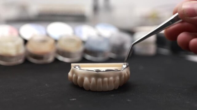 Dental technician positioning metal framework onto beige acrylic upper denture on dark work surface with blurred model cases behind, showing precise prosthetic fitting in clinical laboratory