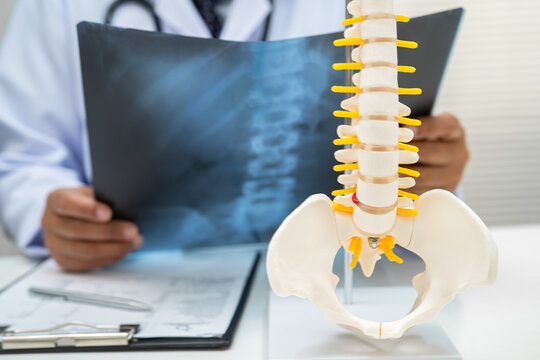 Doctor examining spine bone radiography xray film.
