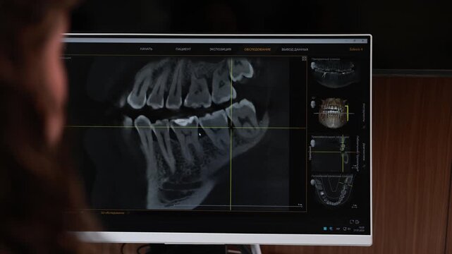 Dental professional reviewing CT and X ray images on clinic monitor during diagnostic consultation with blurred foreground profile and detailed jaw scan display