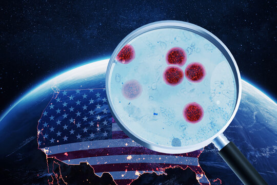 Cyclosporiasis outbreak in the United States concept. Magnifying glass showing microscopic Cyclospora cayetanensis parasites over the US map with flag and Earth background.