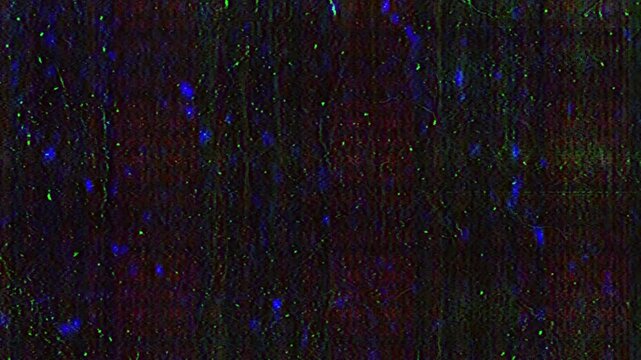 Video signal interference defects with noise malfunction and distorted tv transmission background