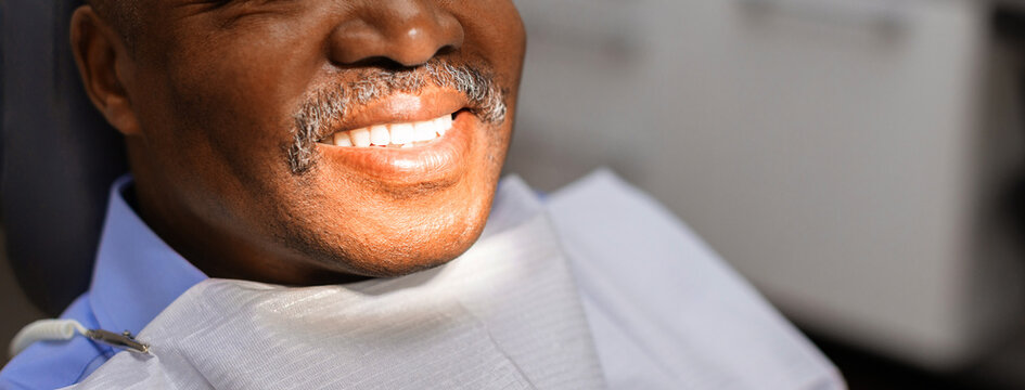 Closeup portrait of smiling black senior male patient showing healthy white teeth after a successful dental procedure in a modern dental clinic with natural lighting