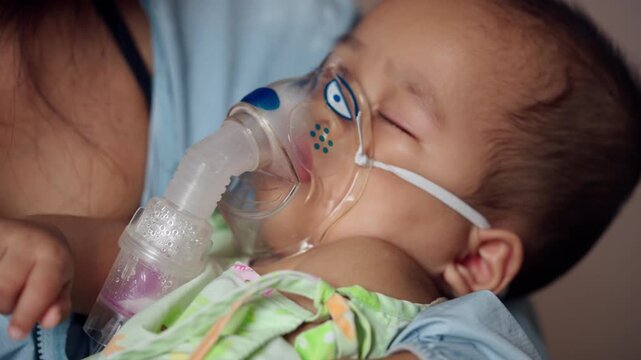 Baby boy rests in a parent's arms while receiving nebulizer therapy for respiratory illness, representing pediatric treatment, lung infection care, medication, and breathing support.