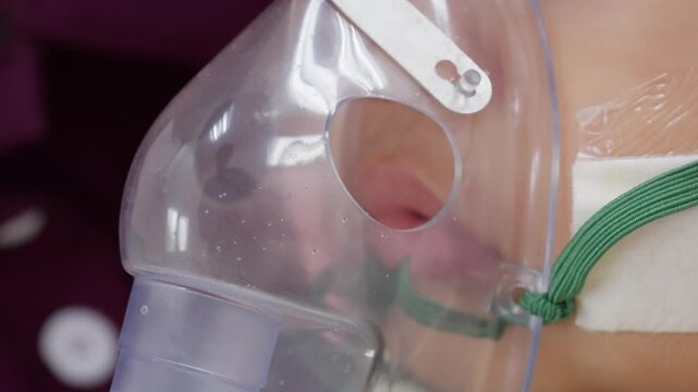 Eight-month-old infant receives pediatric respiratory care using a nebulizer mask, representing hospital treatment for breathing problems, asthma symptoms, and respiratory infection.