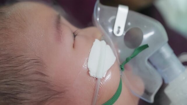 Infant Boy Using Nebulizer Mask for Asthma Treatment at Hospital