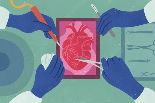 Open Heart Surgery