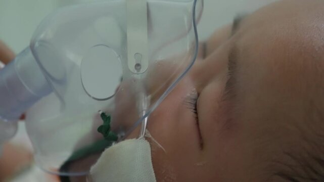 Eight Month Old Baby Boy Receiving Nebulizer Respiratory Treatment in Hospital