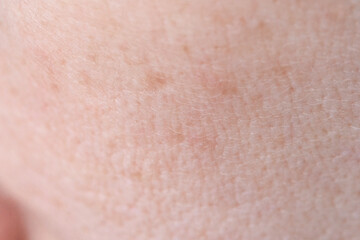 Fototapeta premium Facial Skin Showing Fine Pores Dry Texture And Slight Redness On Cheek Closeup In Neutral Indoor Lighting Macro Clinical Skin Surface Study For Dermatology Reference.