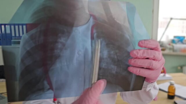 Hands show an x-ray image of a human chest with a pen pointing at a specific area for examination