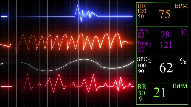 Vital signs monitor waveforms in a dark medical setting with digital readouts and glowing lines indicating health status