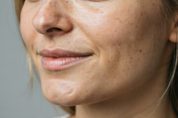 Fototapeta premium Detailed macro shot of a young woman lower face revealing natural skin texture, visible pores, light freckles and subtle skin imperfections