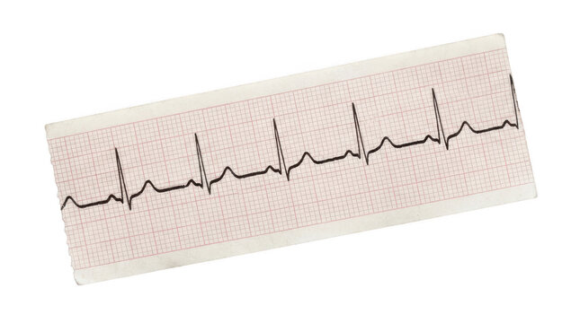 Ecg heart rhythm strip isolated on transparent background