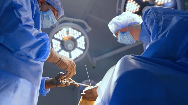 Diverse metal medical tools are applied at the surgery on foot. Surgeon inserts a metal detail to a patient's heel. Low angle view.