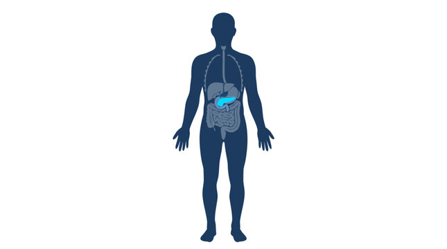 Medical illustration of the human body highlighting the pancreas and digestive system organs