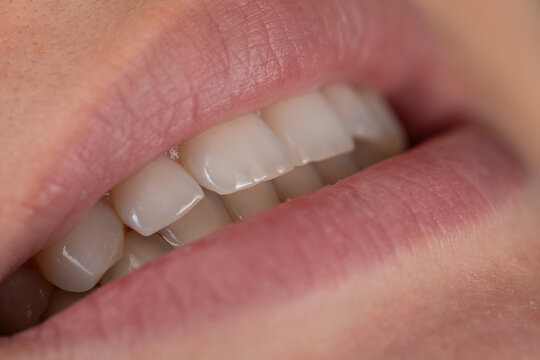 Smiling with perfect white teeth