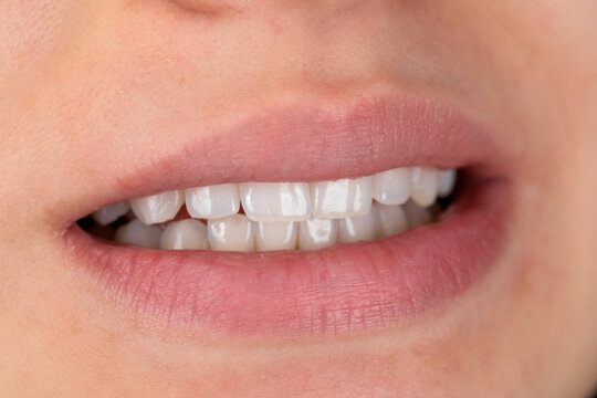 Smiling with perfect white teeth