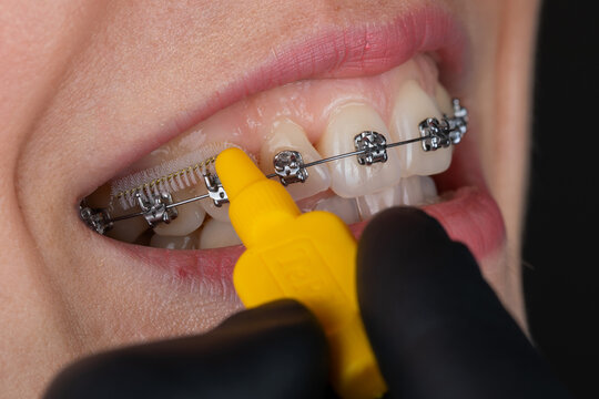  Dental hygiene concept