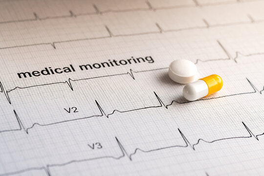 An ECG strip with pills nearby, indicating medical monitoring in a clinical setting.