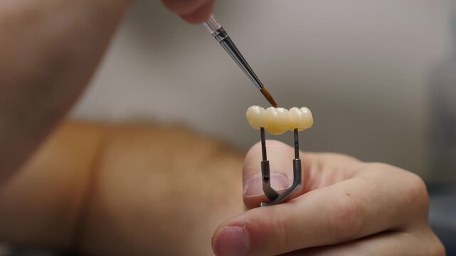 Close-up of technician hands painting dental bridge with fine brush held in tongs. Layered glaze application. Precise staining for natural tooth shade and aesthetic restoration 4k video